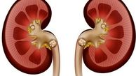  استرسِ ، کدام اندام حیاتی شما را نشانه رفته است؟