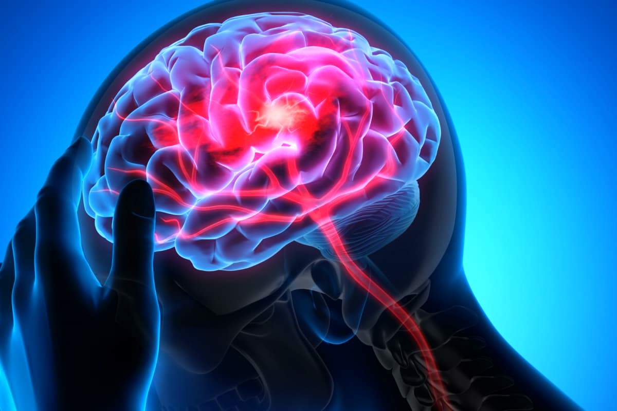  آیا تنها فشار کف پا می‌تواند سکته مغزی را قبل از بروز علائم، افشا کند؟ 